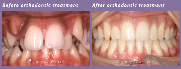 Orthodontics