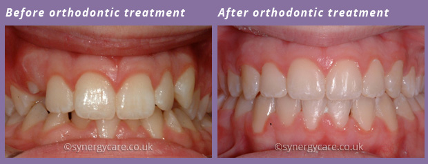 Orthodontics