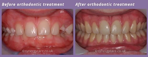 Orthodontics