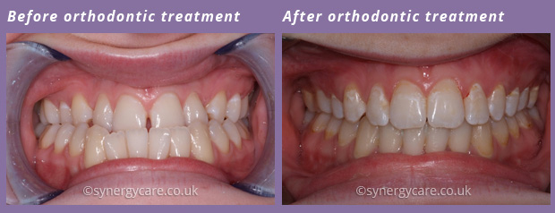 Orthodontics