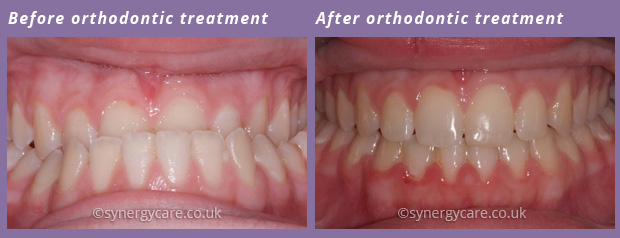 Orthodontics