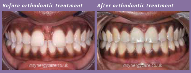 Orthodontics