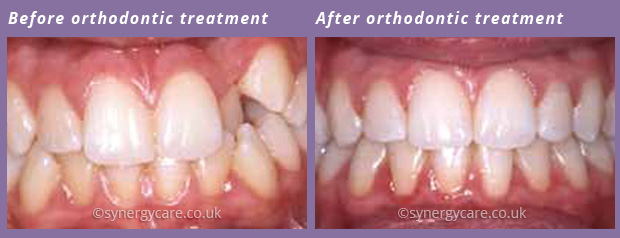 Orthodontics