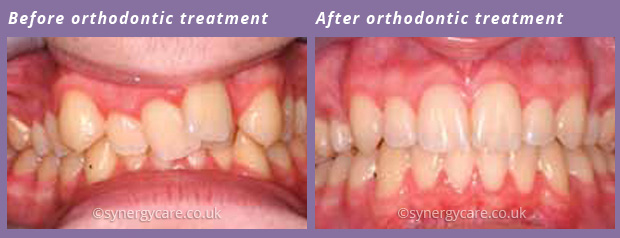 Orthodontics